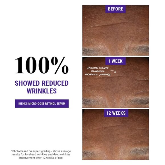 NEW Kiehl's Since 1851 Micro-Dose Anti-Aging Retinol Serum 1.7 oz./100%AUTHENTIC - Picture 3 of 8